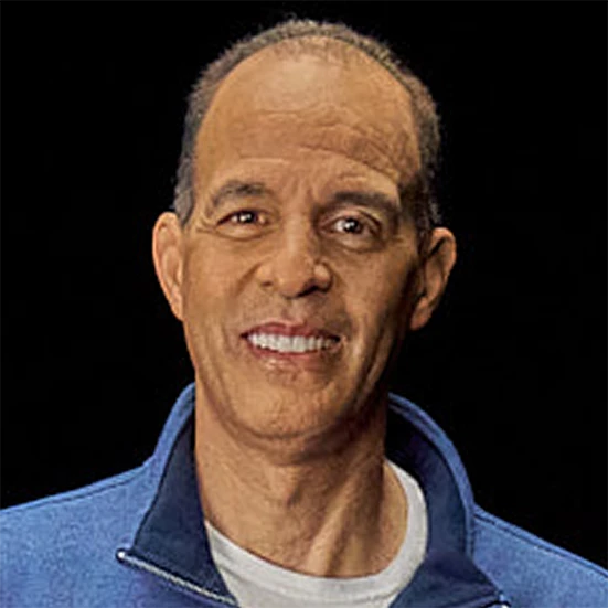 Vitiligo examples: A photo of a real patient smiling and showing off their skin after treatment for vitiligo with Opzelura.