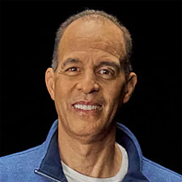 Vitiligo examples: A photo of a real patient smiling and showing off their skin after treatment for vitiligo with Opzelura.