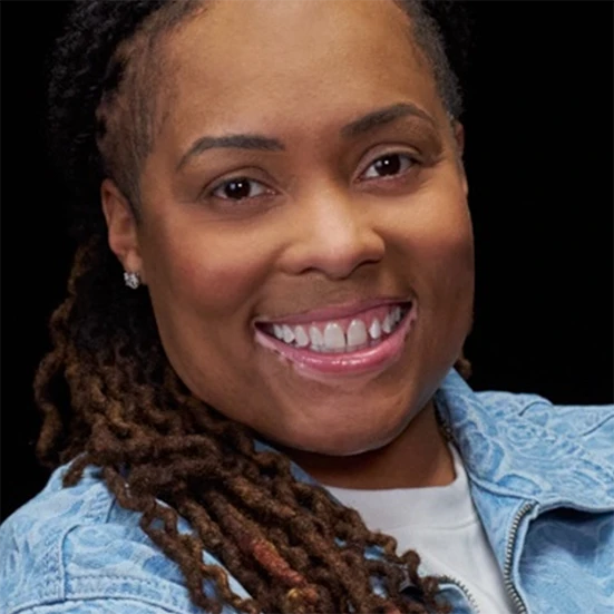 Vitiligo examples: A photo of a real patient smiling and showing off their skin after months of treatment for vitiligo with Opzelura.